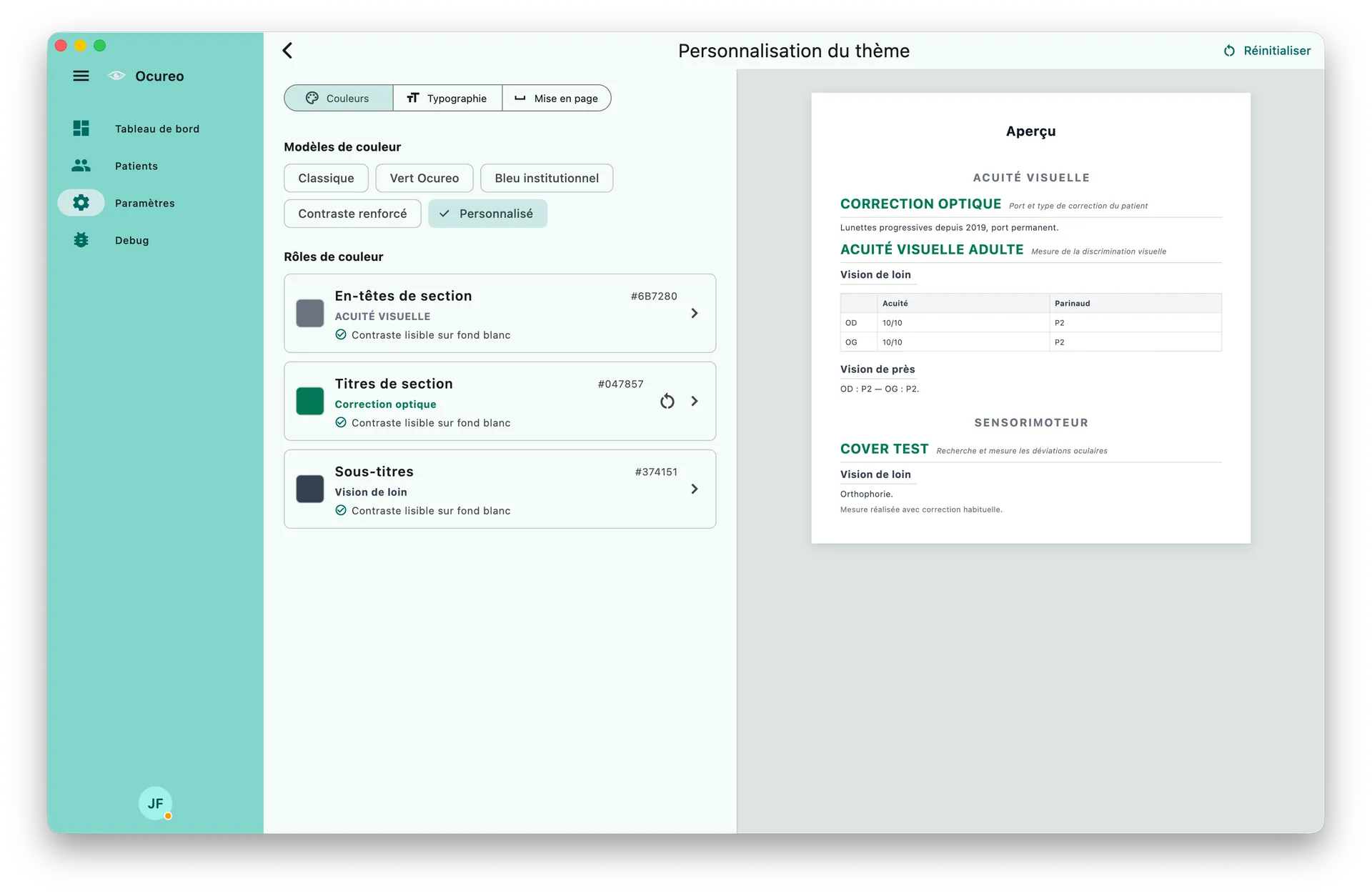 Personnalisation du thème de compte rendu dans Ocureo avec aperçu du document